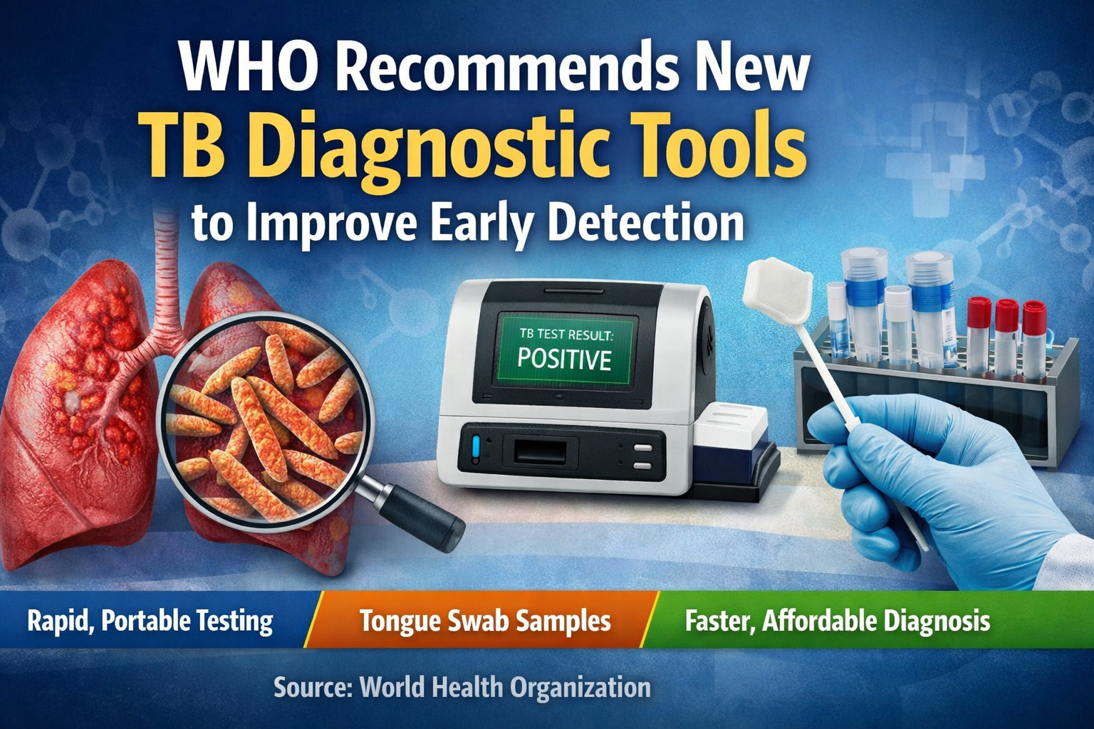 WHO Recommends New TB Diagnostic Tools to Improve Early Detection